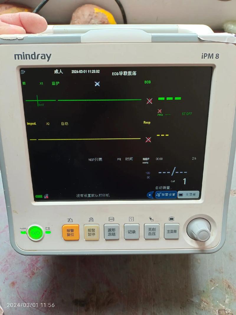 監護儀維修案例分享100例